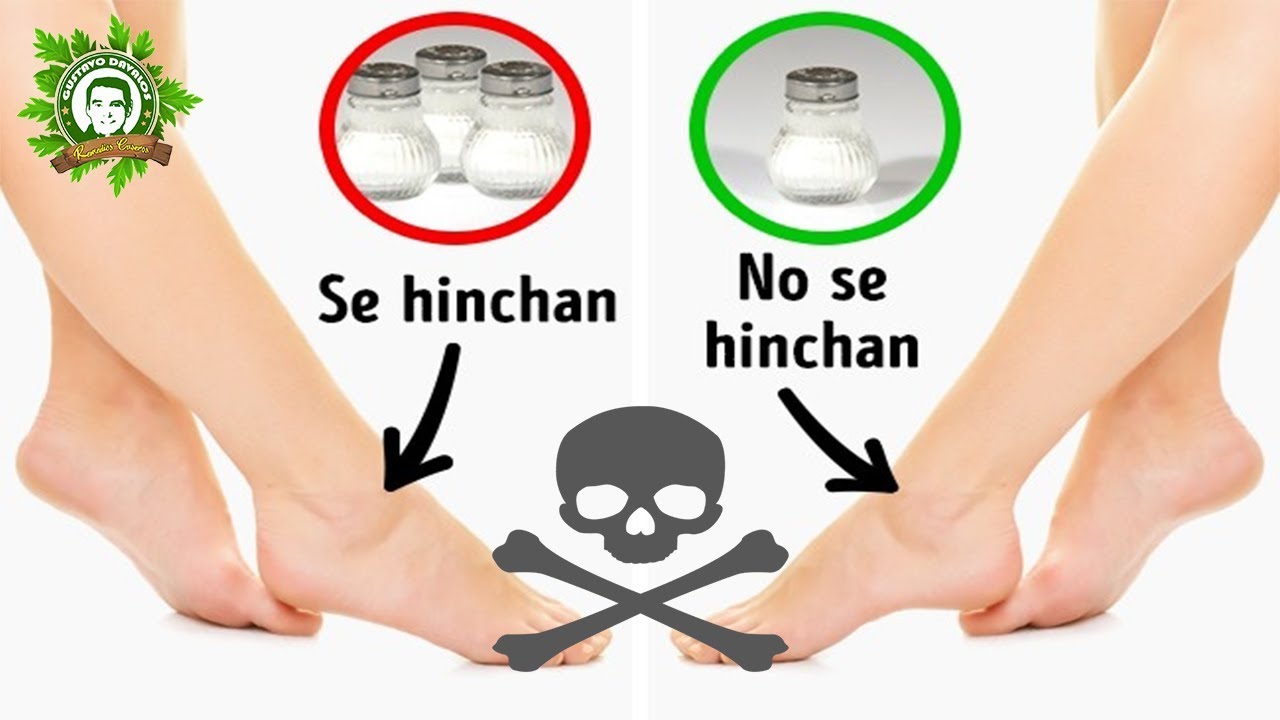 SÍNTOMAS DE QUE TIENES EXCESO DE