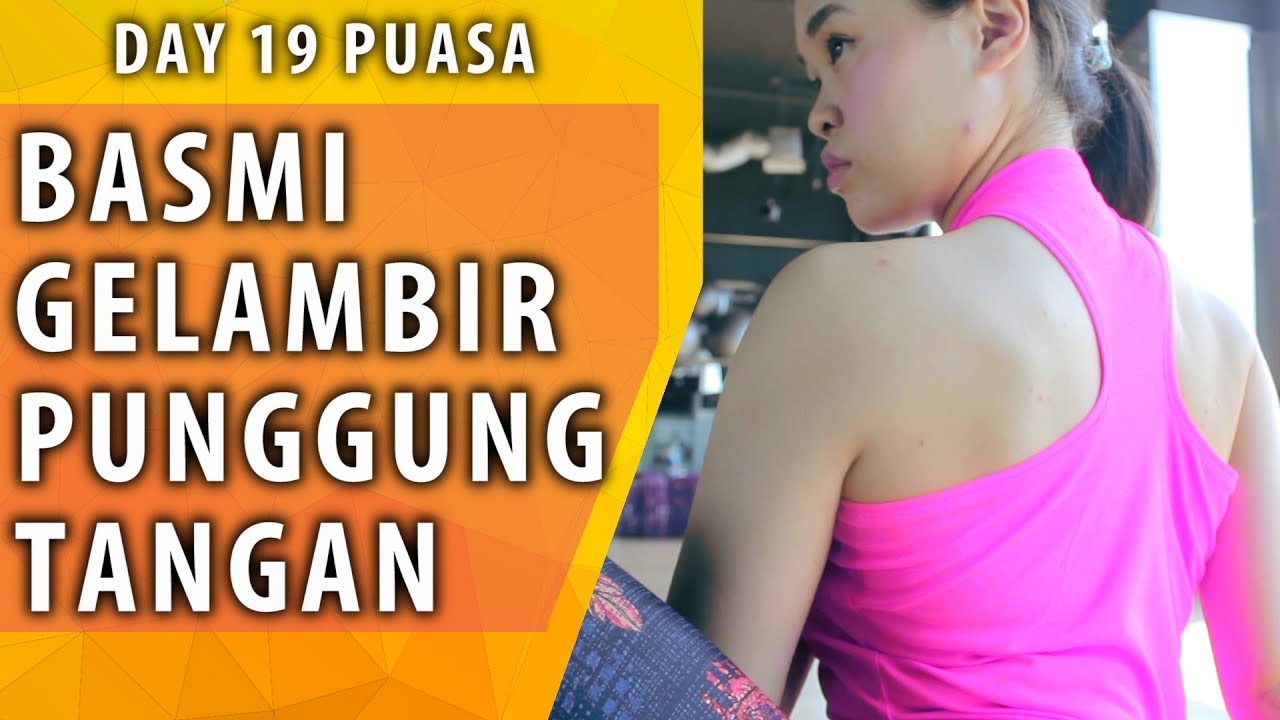 Menghilangkan Lemak Gelambir Punggung + Lengan