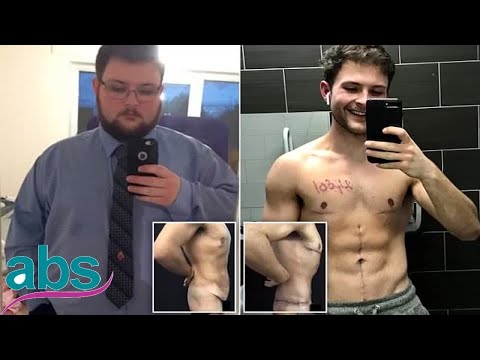 man-undergoes-pioneering-£6000-skin-removal-surgery-|-abs-us-daily-news