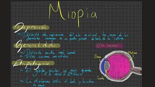 Miopía: Definición, generalidades y tratamiento.