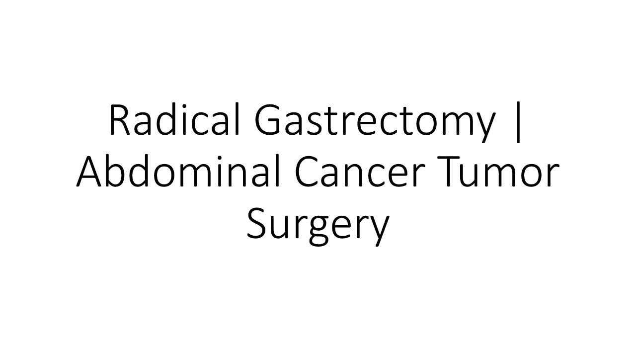 Radical Gastrectomy | Abdominal Cancer Tumor Surgery - Dr Majid Ahmed Talikoti - Surgical Oncologist