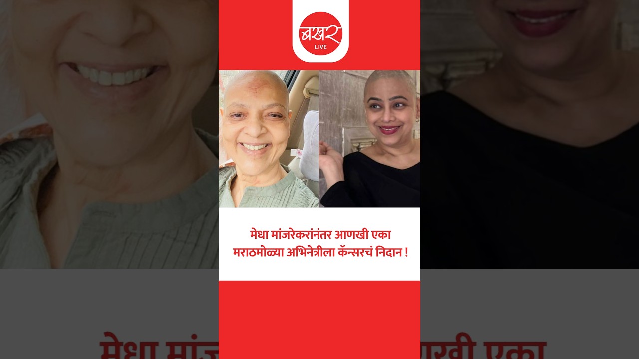 उपचारावेळचे गळालेले केस अन् त्यानंतरचे 'केमो कर्ल्स' केले फ्लॉन्ट !