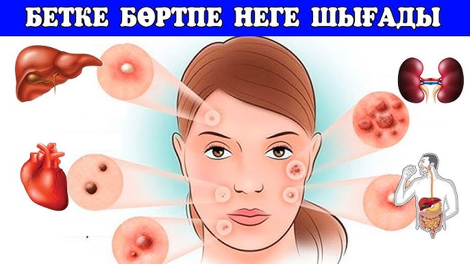 Саққым келеді, бет сүйектерім ауырады