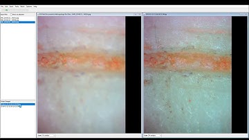 How to Z-Stack Images Using Zerene Stacker