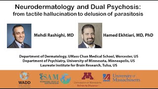 Delusion Of Parasitosis Where Dermatology Meets Neuroscience, Psychiatry And Addiction Medicine