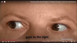 Lecture 9 Part 1 || Information Visualization