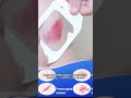 Daily Protection Made Simple | MDK Transparent Film Dressing