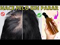 SE TE CAE EL PELO?👉 USA ESTO 2 VECES A LA SEMANA TU CABELLO CRECERÁ COMO LOCO😱