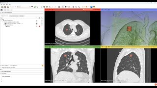 Segmentation Mask Loading and Volume Rendering in 3D Slicer