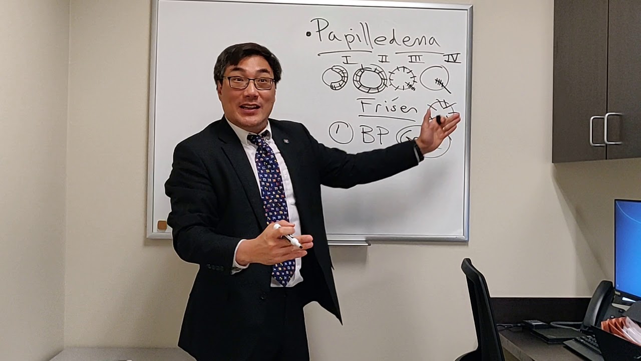 Отек диска зрительного нерва