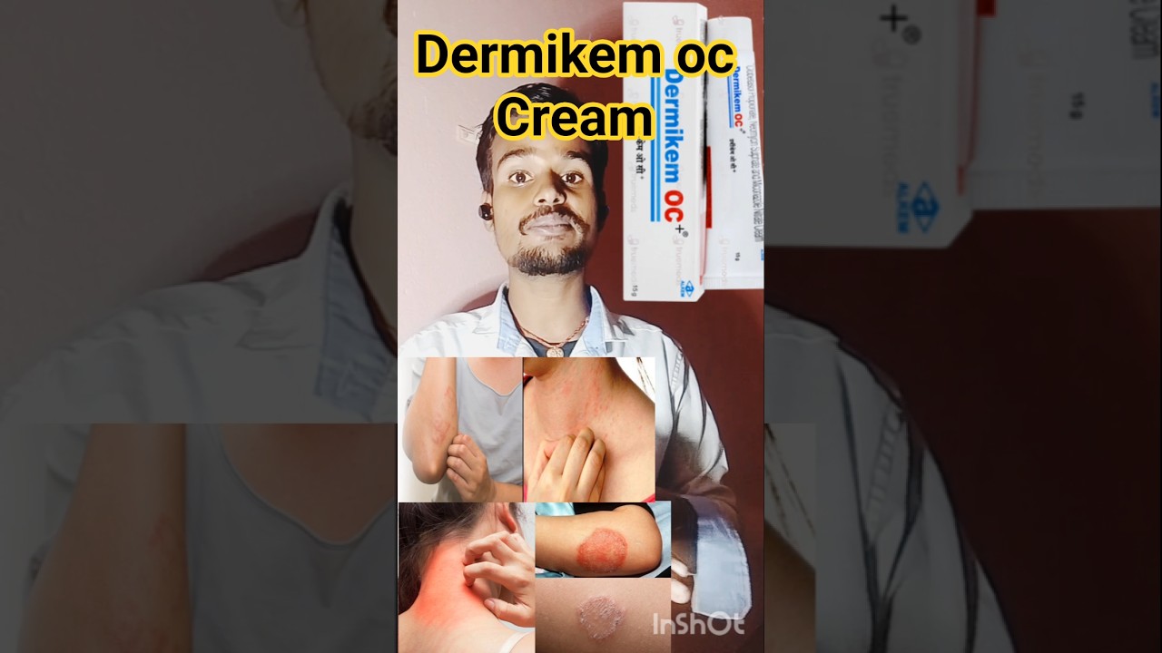 Dermikem oc cream uses in hindi