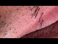 【pull out the beard】ずっと見てられる定番のヒゲ抜き 2018.6.19