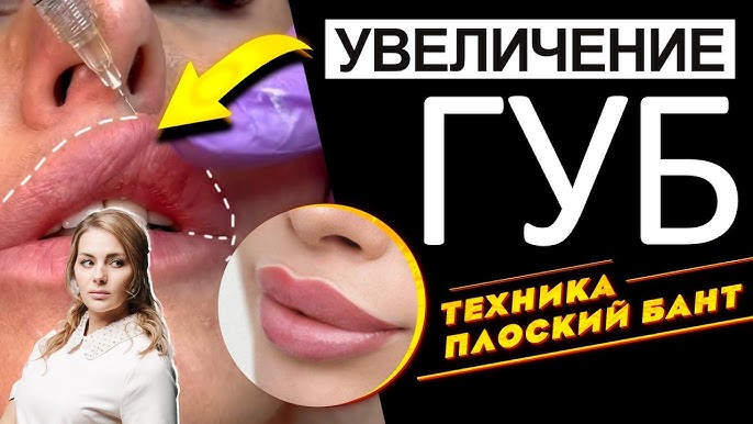 Техника плоский бант увеличение