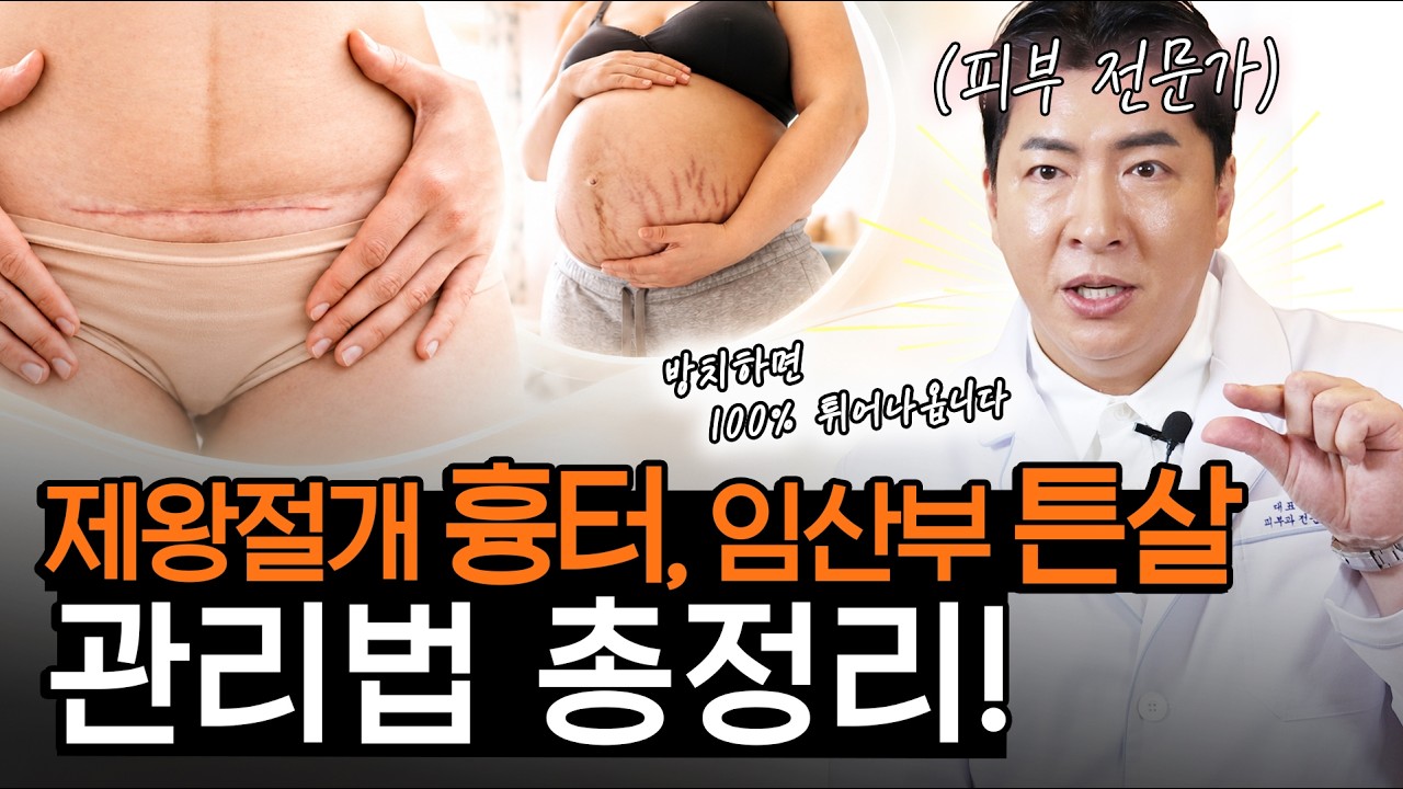 "골든타임 놓치면 평생 안 없어집니다" 임산부 튼살, 제왕절개 흉터 관리법!