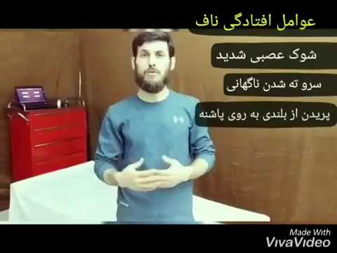اصلاح افتادگی ناف