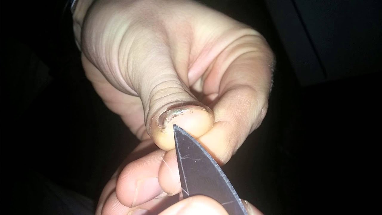 Digging Dried BLOOD From Under Thumbnail YouTube