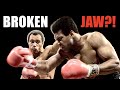 Ali's Toughest Fight Explained! - Muhammad Ali vs Ken Norton | Fight Breakdown