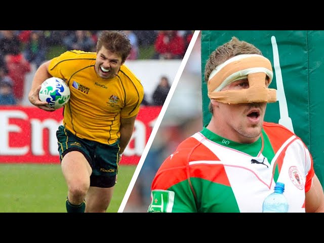 Worst Injuries In Rugby Rugby Injuries Worst