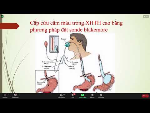 Video Kỹ thuật đặt Aline đo IBP - kỹ thuật đo CVP. 52p. Hồi... - youtube