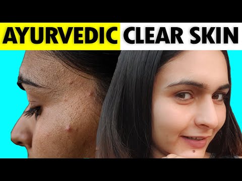 Ayurvedic Formula For Crystal Clear Skin || Acne, Pimple, Dark Spots & Itching