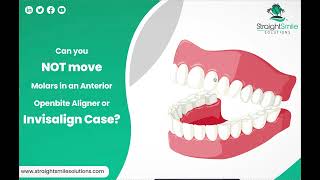 Is it OK not to move Molars in an Invisalign Anterior Openbite Case?