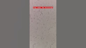 Poop under the microscope #laboratory #microscope #stoolanalysis