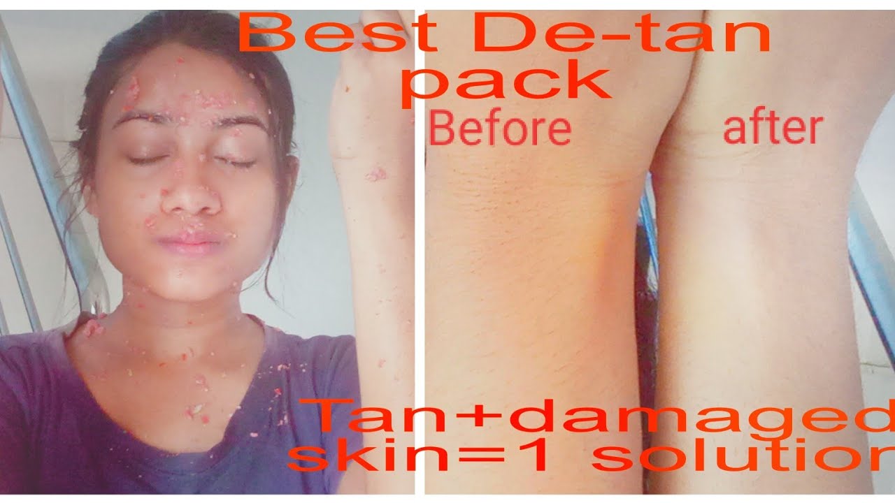 duniya-best-de-tan-pack-tan-remove-15