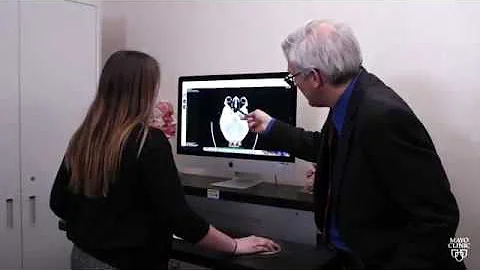 Mayo Clinic Minute: How artificial intelligence could improve outcomes for stroke patients