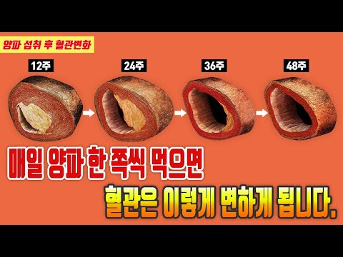 매일 양파 한쪽씩 먹으면 혈관은 이렇게 변하게 됩니다