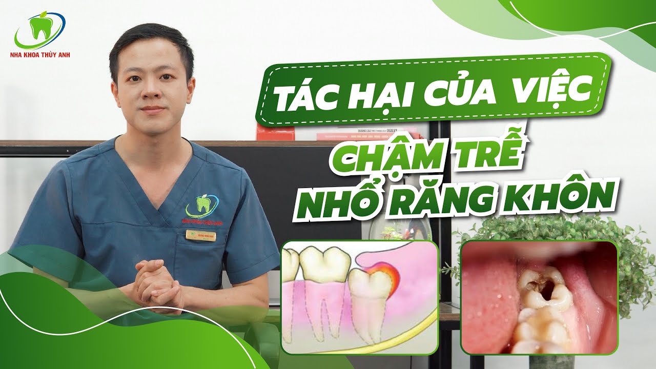 NHỔ RĂNG KHÔN CÓ TỐT KHÔNG?