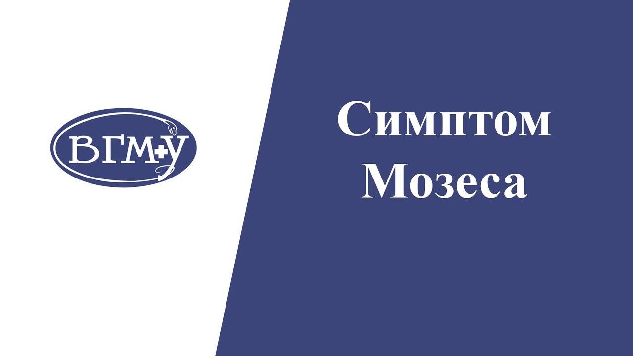 Симптом Мозеса