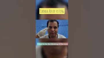 corneal reflex testing | trigeminal nerve | facial nerve  #clinical  #shorts