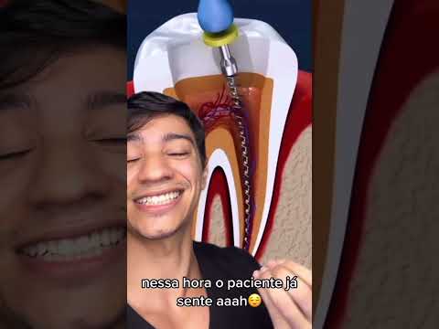 Vídeo: Como lidar com dentes afiados: 12 etapas (com fotos)