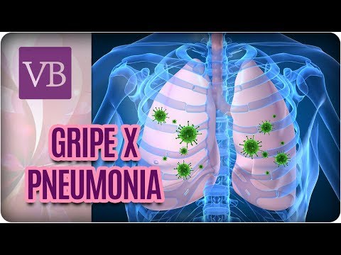 Vídeo: Complicações Da Gripe: Pneumonia, Bronquite E Muito Mais
