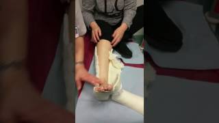 Plaster Cast Removal
