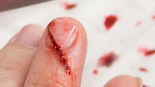 FX Makeup Series: Sliced Nail
Other videos in my FX Makeup Series-
To see whats in my special effects kit:
http://www.youtube.com/watch?v=o6j9hBk-m8g
Infected Stitches using 3rd Degree:
http://www.youtube.com/watch?v=vSKnsrG3Rzg
My Fake Blood Recipe:
http://www.youtube.com/watch?v=lPBeDaFR8PE
Lacerations Using 3rd Degree:
http://www.youtube.com/watch?v=KWffJsjEhX8
Bite Wound Using Rigid Collodion:
http://www.youtube.com/watch?v 8opw4zE5y8
How to make Bruises with Makeup:
http://www.youtube.com/watch?v=7JNqagQx6qk
How to Fake a Black Eye With Makeup:
http://www.youtube.com/watch?v=m4-oSH0VJto
The Chelsea Smile:
http://www.youtube.com/watch?v=ugl9AmySpj0
First Degree Burn (Sunburn with Peeling Skin):
http://www.youtube.com/watch?v=FqdxgFWkfDI
Flesh Eating Bacteria:
http://www.youtube.com/watch?v=QyxxseH8j9Y
Chemical Peel Gone Wrong:
http://www.youtube.com/watch?v=hnjTgMV91x8
Acid Burns:
http://www.youtube.com/watch?v=vyHQMfDDXjg
Second Degree Burn:
http://www.youtube.com/watch?v=Cws07kWu6XY
Third Degree Burn:
http://www.youtube.com/watch?v=oW68-5Bnfpk
Claw Wounds:
http://www.youtube.com/watch?v=9lMDqJoGJSQ
How To Remove FX Makeup:
http://www.youtube.com/watch?v=dBW 5HrfXs
Reattached Hand:
http://www.youtube.com/watch?v=GZnkuuMxQTI
Im Infected:
http://www.youtube.com/watch?v=1RHqJDV1o6M
Zombie Bite:
https://www.youtube.com/watch?v=EWbkXxc_vEo&list=PLc7DwPsXUsLVqNBb5RcAYQzoPY3Q-XP-v&index=20
Broken Nose:
https://www.youtube.com/watch?v=cuT96iqGWOE
Split Brow & Lip:
https://www.youtube.com/watch?v=4GFiYbafHYI
Scraped Knuckles: https://www.youtube.com/watch?v=SgqxRazhRH0&list=UUnqFE2ofL5PhKhoMtl7V4CQ
Bullet Entry Wound: https://www.youtube.com/watch?v C44RrvtgbQ
Bullet Exit Wound: https://www.youtube.com/watch?v=RB2qYLQkqA8
Fire Burn: https://www.youtube.com/watch?v=e-qhDgBWS_I&list=PLc7DwPsXUsLVqNBb5RcAYQzoPY3Q-XP-v&index=25
Acne: https://www.youtube.com/watch?v=6fSfvQI_TE4
Frostbite: https://www.youtube.com/watch?v=sYi6lav5HZg
Sliced Fingertip: https://www.youtube.com/watch?v=HKS2VhewZS4
Join me here too:
INSTAGRAM: http://instagram.com/goldiestarling
TWITTER: http://twitter.com/goldiestarling
FACEBOOK: https://www.facebook.com/pages/Goldiestarling/110393895647738
MUSIC: Youtube Audio Library FX Makeup Series: Sliced Nail