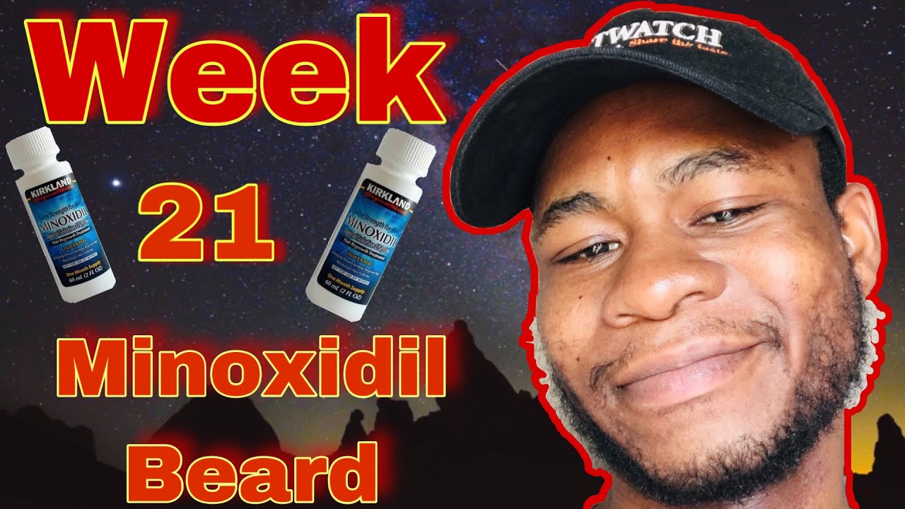 minoxidil-beard-journey-minox-shedding-phase-week21-youtube