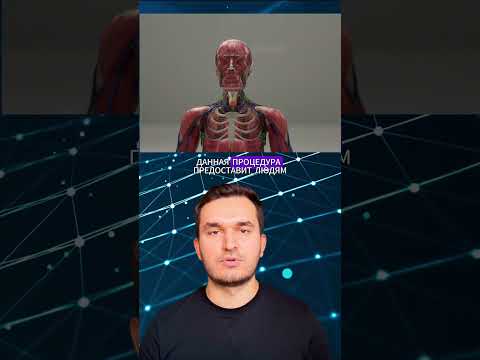 Пересадка головы будет