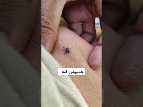 چسبیدن کنه حین استراحت در طبیعت Tick Animals Backpacking Hiking Travel Adventure Wildlife