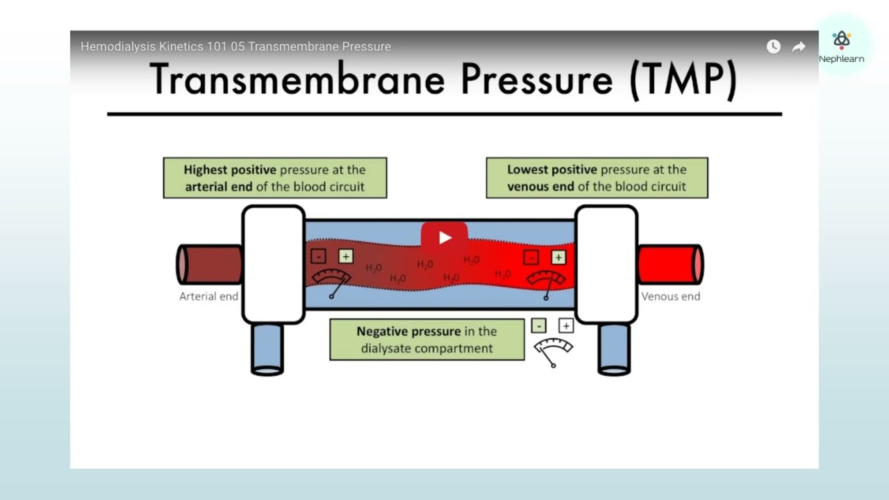 Сигнализация диализного аппарата — Часть 2! 