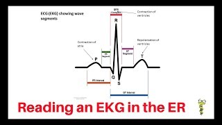 How to quickly read an EKG in the emergency department