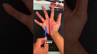 Papai Se Machucou 😱