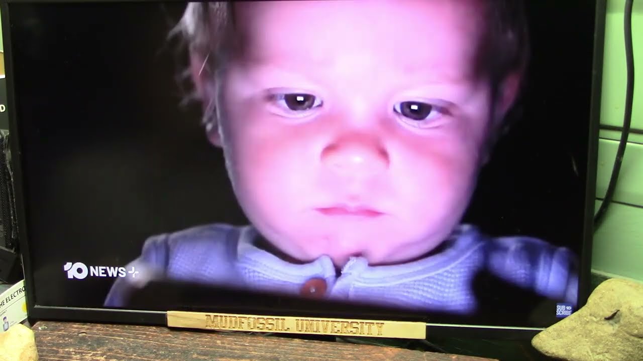 White Matter Changes in Young Children's Brains and Screen Time