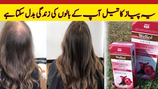Ab Sab Oils Ko Kar do Bye | Review of Wellice onion Anti hair fall shampoo || Hair fall solution