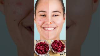 Pink face mask for skin whitening and dark spots removal ashortaday trending pigmentation