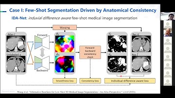 MICCAI Industrial Talk: Data- and Annotation-Efficient Deep Learning for Medical Image Analysis