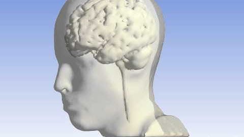 Brain Ventricle Analysis