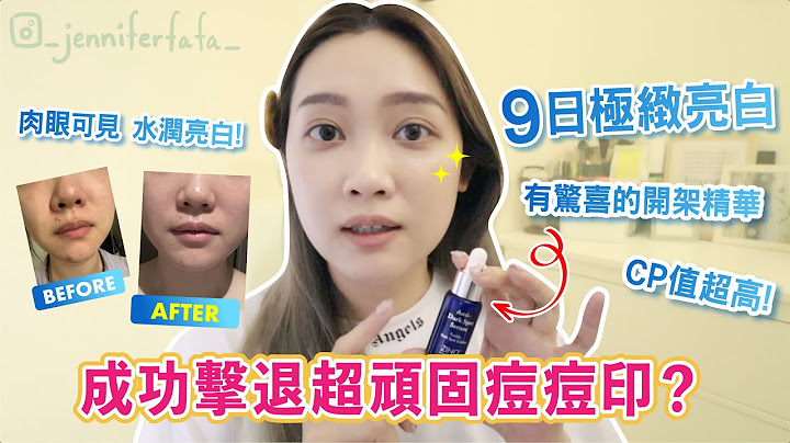 ZINO激白淡斑精華｜9日極緻亮白 撃退色斑62%*💎｜人氣Youtuber Jennifa 大推︰成功擊退痘痘印色素！🥊重拾無瑕亮白肌膚✨ 敏感肌都OK! 美白超有感 CP值很高的美白精華💧 - 天天要聞