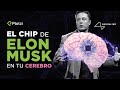 🧠 Qué es Neuralink: un chip en tu cerebro