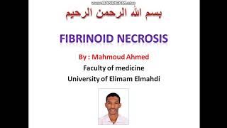 ١١/ شرح ال Fibrinoid necrosis - #محمود_احمد_SDLC